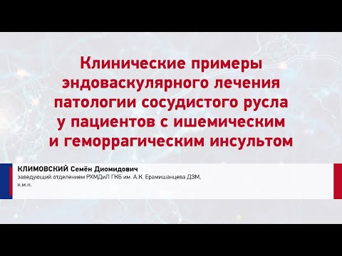 Видео: Климовский С.Д. Клинические примеры эндоваскулярного лечения патологии сосудистого русла у пациентов