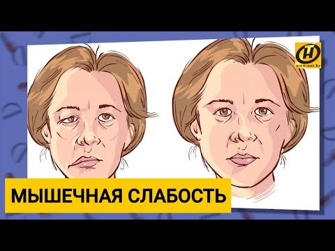 Видео: Миастения или слабость мышц - что это и как лечить?