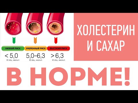 Видео: КАК ЭТО ВОЗМОЖНО? 87 лет - Холестерин и Сахар в НОРМЕ!