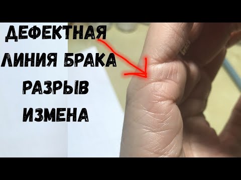 Видео: Линия брака дефектная. Разрыв и наклон вниз к линии сердца. Кармический партнер/Хиромантия