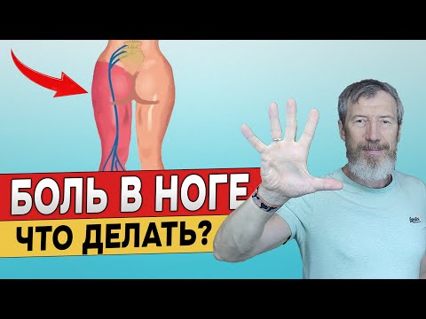 Видео: 5 Упражнений от Защемления Седалищного Нерва. Забудьте про боль в спине и ногах.