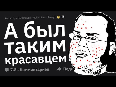 Видео: Во Что ПРЕВРАЩАЮТСЯ Одноклассники Через 10 Лет