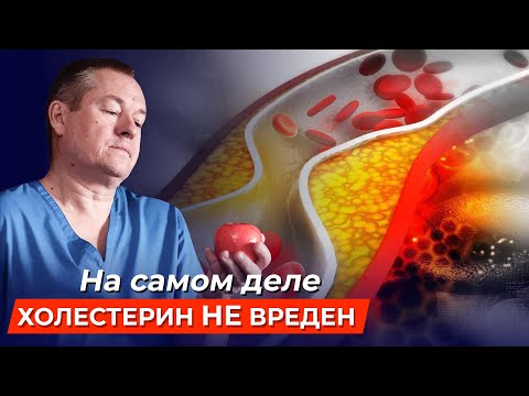 Видео: Почему НЕ НУЖНО СНИЖАТЬ ХОЛЕСТЕРИН? Профилактика АТЕРОСКЛЕРОЗА И ТРОМБОЗА
