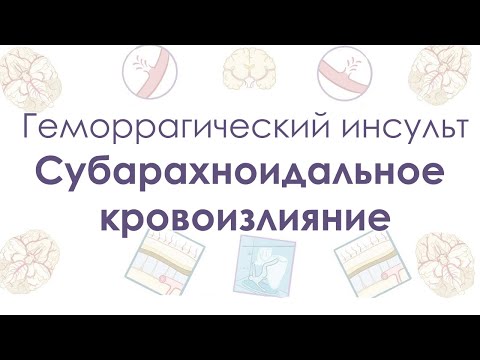 Видео: Геморрагический инсульт - Субарахноидальное кровоизлияние