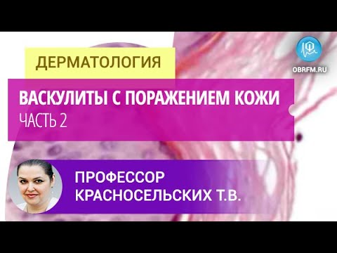 Видео: Профессор Красносельских Т.В.: Васкулиты с поражением кожи. Часть 2