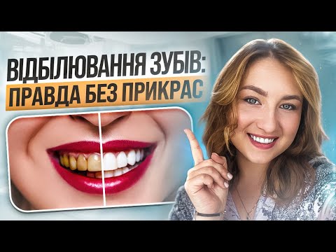 Видео: 🇺🇦 Отбеливание зубов: правда, которую не расскажут в рекламе