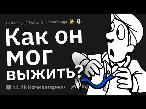 Видео: Как он Мог ВЫЖИТЬ? Врачи в Шоке!
