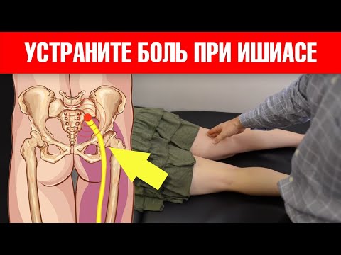 Видео: 3 шага для снятия боли в пояснице. Ишиас седалищного нерва