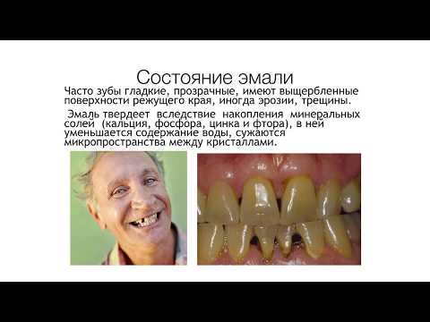 Видео: Состояние зубочелюстной системы у пожилых. Практическое занятие.