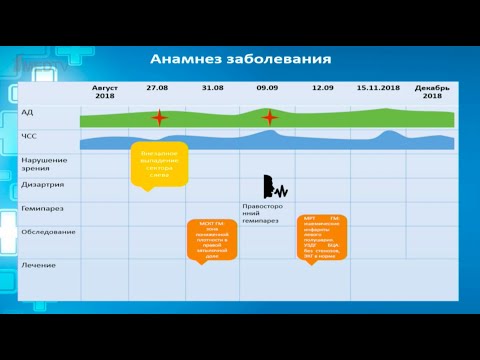 Видео: Неясные причины повторных инсультов. Клиническое наблюдение.