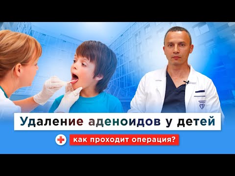 Видео: Надо ли удалять детям аденоиды? Как удаляют аденоиды бесплатно по ОМС в Морозовской больнице