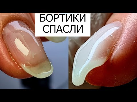 Видео: БОРТИКИ спасли ЭТИ НОГТИ ///  NailsMaster