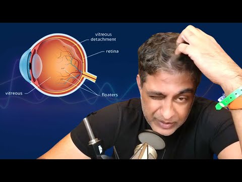 Видео: Мой опыт лечения задней отслойки стекловидного тела