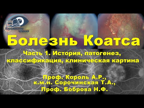 Видео: Болезнь Коатса. Часть первая. Диагностика, клиническая картина