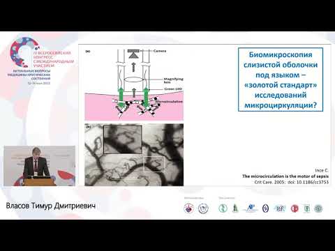 Видео: Микроциркуляция при критич сост Власов Т.Д.
