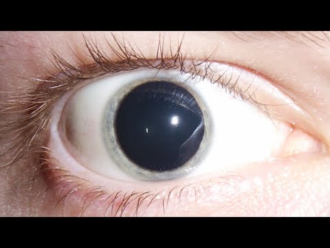 Видео: Как это открытие помогло раскрыть дело об изменённом психическом состоянии