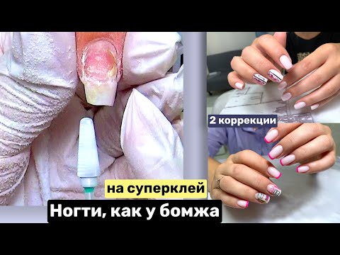 Видео: Ногти на суперклей. Отслойки. Коррекция ногтей на клиенте.
