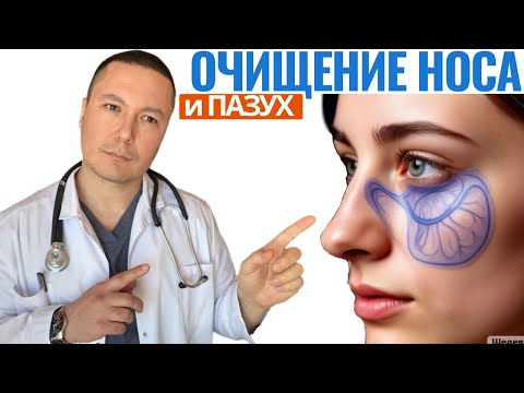 Видео: Секретные техники очищения пазух без лекарств. Рассказывает Врач терапевт с огромным стажем