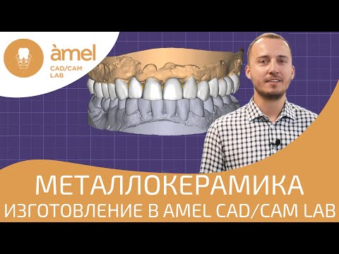 Видео: Изготовление металлокерамики в Bauers Cad/Сam Lab