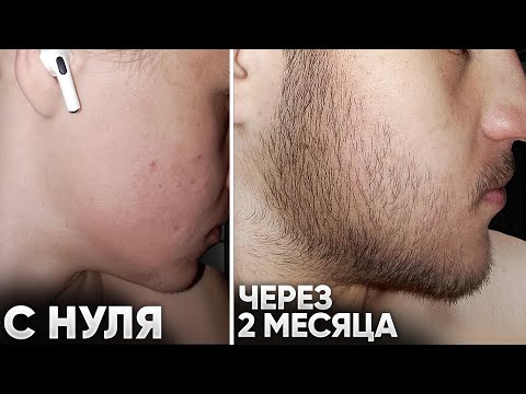 Видео: Вот какие результаты С НУЛЯ за 2 месяца от mr.Volos / Средство для роста бороды