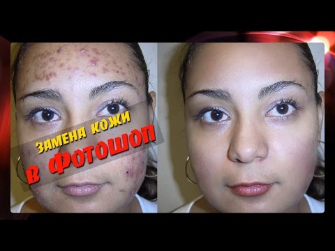 Видео: Ретушь лица в Фотошоп. Проблемная кожа. Пересадка кожи с другого лица