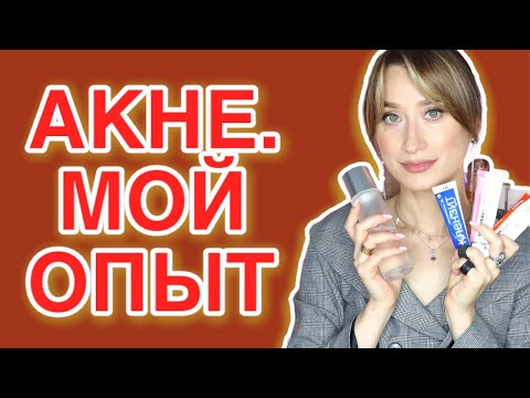 Видео: КАК Я ВЫЛЕЧИЛА АКНЕ ЗА МЕСЯЦ Уход и лечение