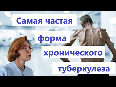 Видео: Фиброзно-кавернозный туберкулеза