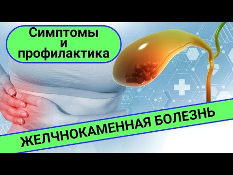 Видео: ЖЕЛЧНОКАМЕННАЯ БОЛЕЗНЬ: симптомы и профилактика