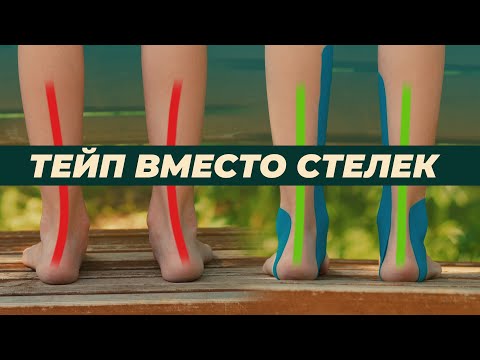 Видео: Тейп вместо стелек. Поддержка стопы в открытой обуви для детей и взрослых