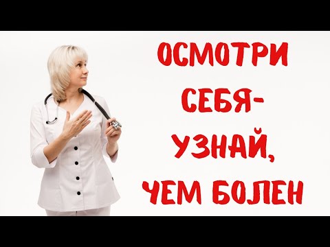 Видео: Осмотри себя, и узнай, чем болен. Доктор Лисенкова