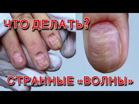 Видео: Волнистые ногти. Можно ли такое красить?