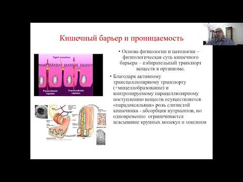 Видео: Синдром воспалённого кишечника в практике прикладной кинезиологии