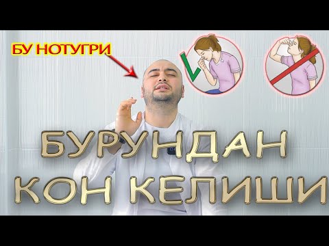 Видео: Уй шаройитида бурундан кон кетишни тухтатиш, Бурун конашига нима сабаб.