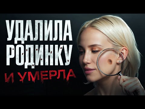 Видео: Удаление родинок – все ЗА и ПРОТИВ. Почему вы НЕ удаляете родники?