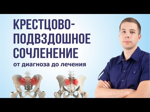 Видео: Крестцово-подвздошный сустав. Как лечить? Симптомы и диагностика