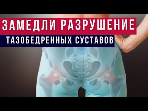 Видео: Активируем ягодицы и Убираем скованность в тазобедренных суставах. Пилатес #7