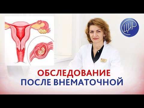 Видео: Внематочная беременность. Какое обследование после внематочной беременности и когда можно беременеть