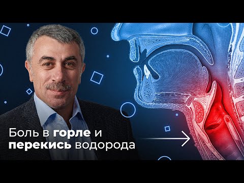 Видео: ШДК: Боль в горле. Перекись водорода - Доктор Комаровский