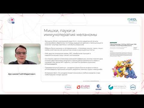 Видео: Синдром Шарля-Бонне (зрительные галлюцинации при утрате/снижении зрения). Арсланов Г.М.