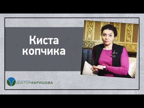 Видео: Киста копчика. Эпителиальный копчиковый ход