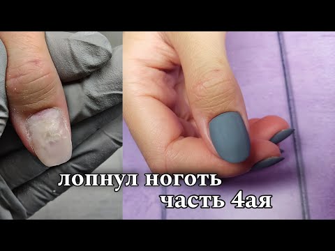 Видео: 😨Это НЕЛЬЗЯ покрывать!❓/лопнул ноготь/ часть 4