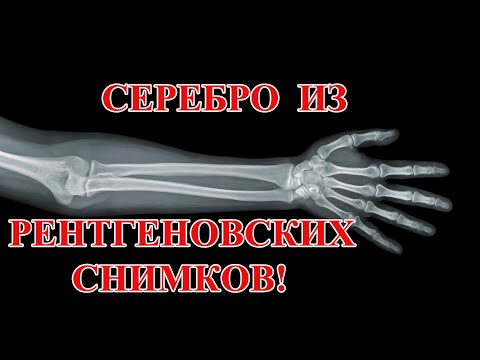 Видео: СЕРЕБРО ИЗ РЕНТГЕНОВСКИХ СНИМКОВ 400гр!