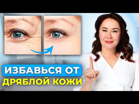 Видео: Как убрать МОРЩИНЫ вокруг ГЛАЗ? ОМОЛОДИ кожу прямо сейчас!