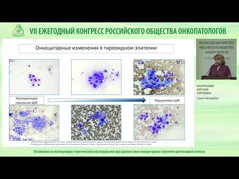 Видео: Возможности молекулярно-генетического исследования при диагностике онкоцитарных опухолей щитовидной