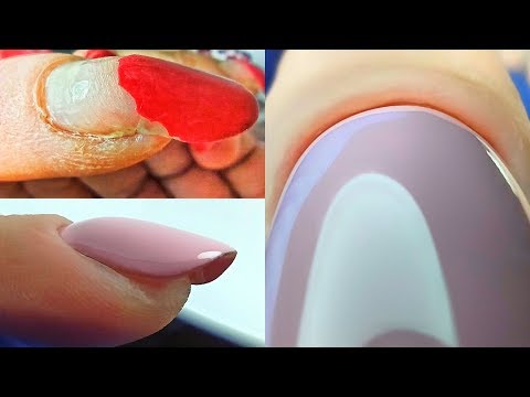 Видео: Очень Клюющий Ноготь!!! Поднятие Ногтя/ Сложная Коррекция/ Маникюр Одной Фрезой/ Виктория Авдеева