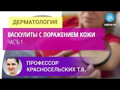 Видео: Профессор Красносельских Т.В.: Васкулиты с поражением кожи. Часть 1
