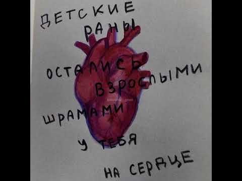 Видео: каспийский груз - детство (slowed)