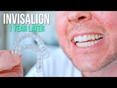 Видео: 10 вещей, которые я хотел бы знать ДО того, как сделать Invisalign!