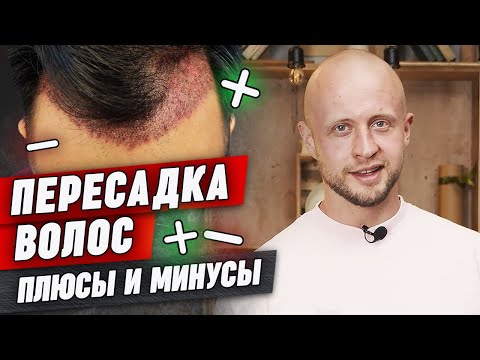Видео: Пересадка волос — все ЗА и ПРОТИВ | Кому подойдёт трансплантация волос?