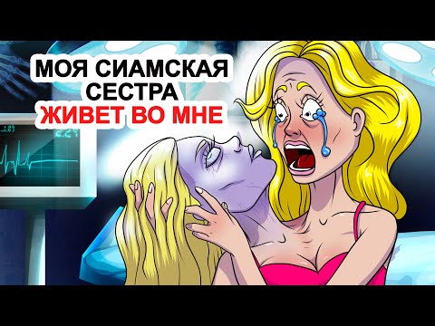 Видео: Моя Сиамская Сестра Живет Во Мне